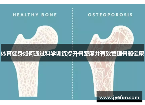 体育健身如何通过科学训练提升骨密度并有效管理骨骼健康